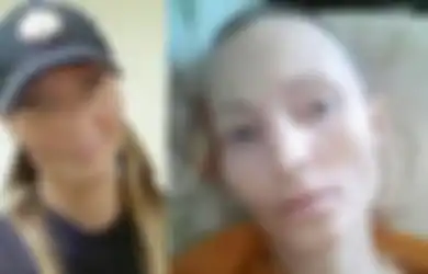 Kisah Polisi Wanita yang Meninggal Karena Tertular TBC dari Tersangka yang Meludahi Wajahnya