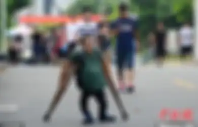 Li Longbiao, Mahasiswa Berprestasi yang Menderita Tumor Tulang Belakang