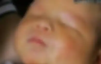 Liu Peihua Melahirkan Bayi Tanpa Dua Mata