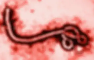 HIV Belum Ada Apa-apanya, Ini 10 Virus Paling Mematikan di Dunia
