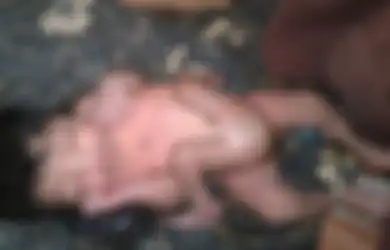 Di India, Ada Bayi Lahir dengan Empat Kaki dan Dua Penis