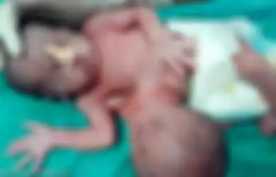 Suami Istri Ini Tetap Merasa Sedih Meski Dokter Berhasil Lepaskan ‘Parasit’ dari Tubuh Bayinya