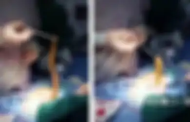 Dokter di China Temukan Belut Hidup di Perut Pasien, Ternyata Sengaja Dimasukkan Lewat Anus untuk Pengobatan Tradisional