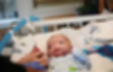 Bayi yang Lahir Tanpa Hidung dan Memikat Dunia Itu Meninggal Tragis pada Usia 2 Tahun