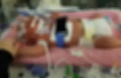 Sedih, Bayi Berusia 18 Hari Ini Meninggal Karena Dicium Oleh Orang yang Terkena Virus Meningitis