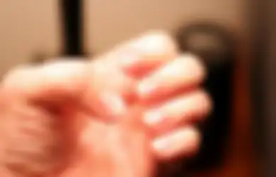 Bintik-bintik Putih pada Kuku Salah Satu Tanda Anda Sedang Diserng Stres