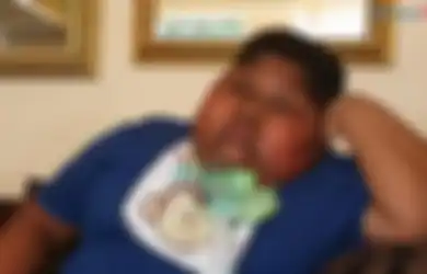 Kasihan! Akibat Sindrom Langka, Anak Ini Tak Bisa Menahan Lapar. Sampai-sampai Tisu Toilet Pun Dimakan