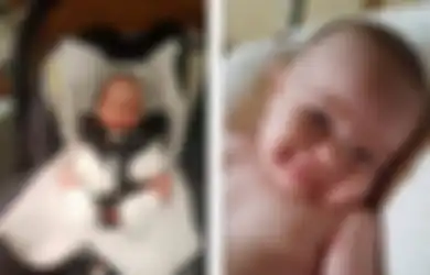 Sedih, Ibu Ini Tak Bisa Memeluk Bayinya yang Menderita Penyakit Langka