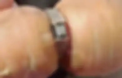 Kocak, Cincin Pertunangan yang Dikira Hilang 13 Tahun Lalu Ditemukan di Sebuah Wortel