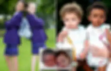 Unik dan Langka, Anak Kembar Ini Terlahir dengan Perbedaan Warna Kulit