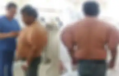 (Video) Lakukan Ini saat Kembali ke Permukaan, Tubuh Penyelam Ini Berubah Hingga Disebut ‘Manusia Balon’