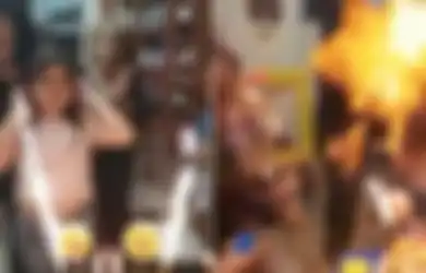 Mengerikan, Anak Perempuan Ini Terbakar Saat Meniup Lilin di Kue Ulang Tahunnya