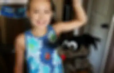 Inspiratif, Bocah 10 Tahun Ini Berhasil Jadi Penyintas Sebuah Kanker Payudara Langka