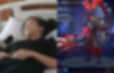 Peringatan Buat Semua Orang! Terlalu Sering Bermain Game Online, Salah Satu Mata Wanita Ini Alami Kebutaan