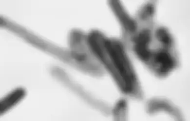 Sudah Tewaskan 3 Orang, Inilah Penjelasan Virus Marburg yang Mirip dengan Virus Ebola