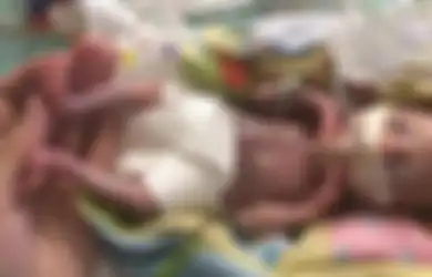 Diberi Label ‘Bayi Paling Prematur yang Pernah Ada’, Bayi ‘Ajaib’ Ini Berhasil Tumbuh Sehat
