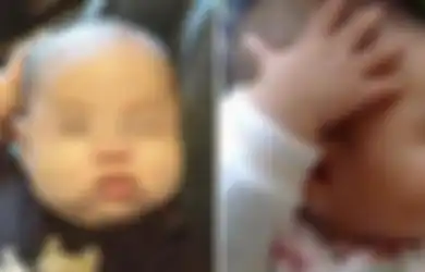 Orangtua, Jangan Pernah Abaikan Gerakan Berulang yang Dilakukan Bayi! Kasus Ini Contohnya
