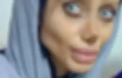 Bukan Cuma Berpotensi ‘Gagal’, Operasi Plastik yang Dilakukan ‘Angelina Jolie’ Juga Bisa Membahayakan