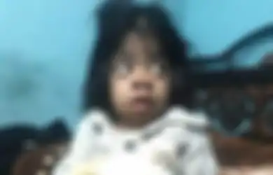 Kasihan, Gadis Cilik Ini Derita Hernia Tali Pusar yang Menggantung di Perut. Beratnya Mencapai 1 Kg