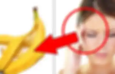 Hebat! Tak Perlu Minum Obat, Migrain Bisa Disembuhkan 'Hanya' dengan Kulit Pisang
