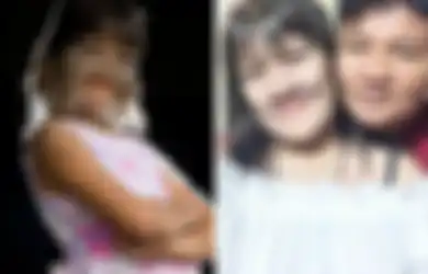 Betapa Bahagianya si ‘Perempuan Serigala’ yang Menemukan Jodoh Setelah Mencukur Semua Bulu di Wajah dan Tubuhnya Ini