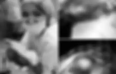 Tega! Para Perawat Ini Ber-selfie di Depan Pasien yang Sekarat dan Organ Tubuh Pasien yang Dioperasi