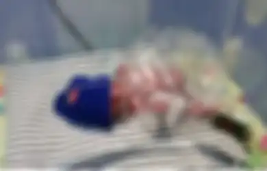 Dokter Bilang Hanya Bisa Selamatkan Nyawa Sang Ibu, Alhasil Bayi Mungil Ini Harus Berjuang Keras Untuk Tetap Hidup