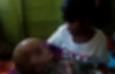 Setelah Menempuh Perjalanan Jauh, Bayi Penderita Hidrosefalus Ini Akhirnya Dirawat di Jakarta