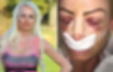Pengakuan Seorang Wanita yang Terobsesi Menjadi Barbie di Dunia Nyata, 'Saya Membenci Hidung Saya Sejak Masih Remaja'