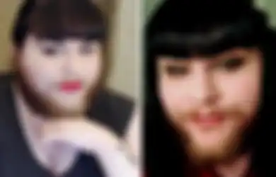 Tak Pandang Kekurangan, Wanita dengan Jenggot Ini Akhirnya Menemukan Cinta Sejatinya