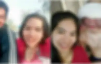 Kekasihnya 'Kehilangan' Wajah karena Tumor, Wanita Ini Berjanji Tak Akan Pernah Meninggalkannya!