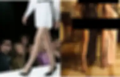 Bukan Lagi Wajah, Tren Operasi Plastik Kini Beralih Menjenjangkan Kaki Demi Terlihat Seperti Selebritas