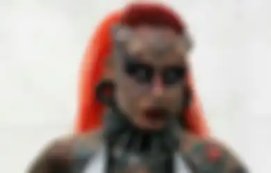 Dari 'Wanita Vampir' hingga 'Alien', Inilah 10 Hasil Operasi Plastik yang Paling Mengerikan