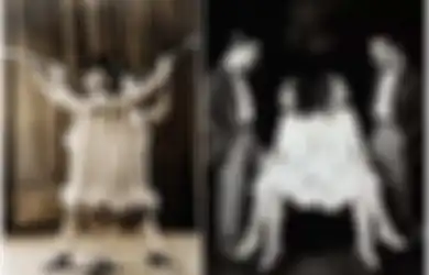 Kisah Anak Kembar Siam Paling Tragis Dalam Sejarah, Mereka Diperalat Sebagai Mesin Pencari Uang!