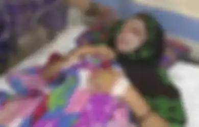 Wajah Ibu Ini Disiram Air Keras oleh Suami Sendiri Gara-gara Melahirkan Seorang Bayi Perempuan