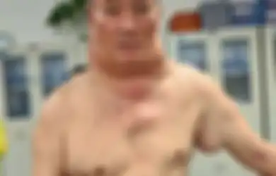 Kecanduan Berat Minum Minuman Penambah Stamina Membuat Pria ini Berubah Menjadi 'Hulk'