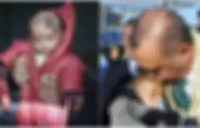 Bayi Suriah 'Bermata Satu' Disambut Hangat oleh Presiden Recep Erdogan saat Tiba di Turki