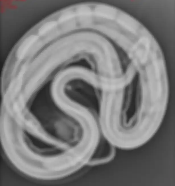X ray