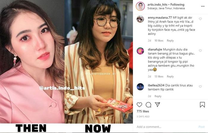 Perubahan wajah Via Vallen kini tuai pro kontra netizen.
