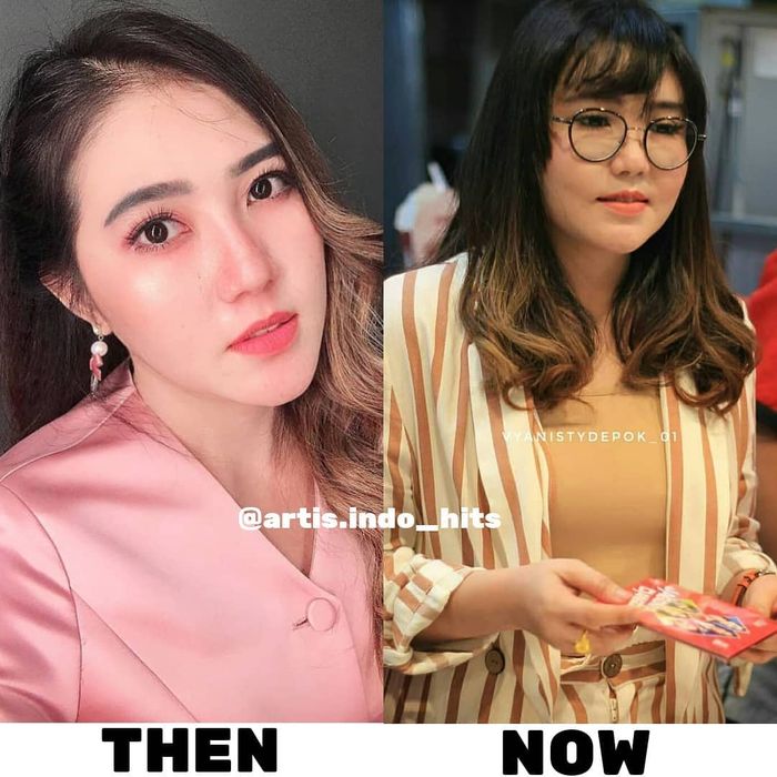 Kok Bisa Wajah Via Vallen Berubah Drastis, Sempat Diduga Operasi