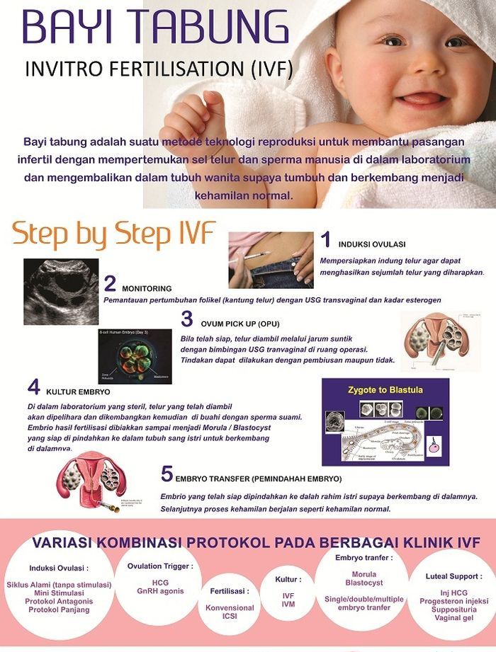 Wow, Benarkah Anak Hasil Bayi Tabung Lebih Pintar dari Anak Lainnya