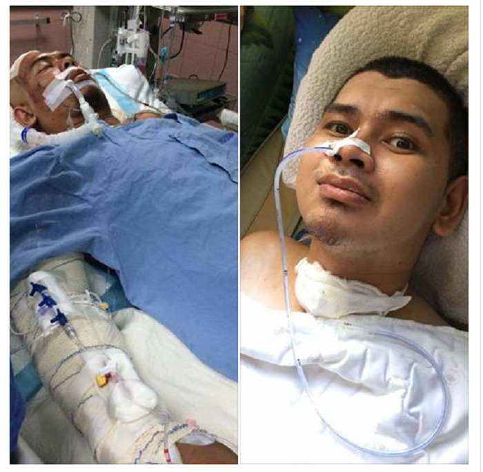 Keadaan Ridhwan pasca kecelakaan