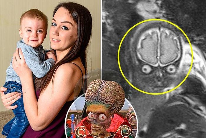 
Foto MRI anak Laura mirip alien dalam film. 