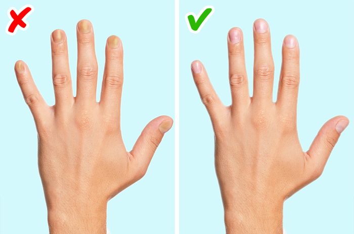 Serangan Sakit Jantung Gejala Penyakit Jantung Punca Sakit Jantung Lemah Jantung Tanda Cara Beauty Health