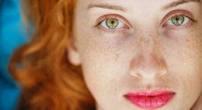 Selain Kurang Tidur Ternyata Mata Panda Juga Disebabkan 5 Hal Ini Semua Halaman Cewekbanget