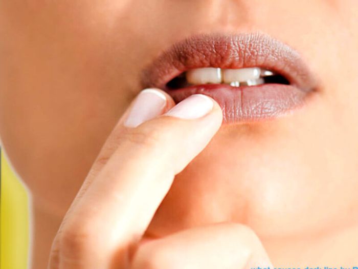 warna bibir gelap, ini bahan alami untuk cerahkannya