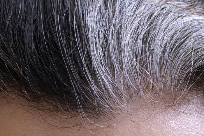 tribunnews
Medical News Today / Ilustrasi rambut beruban