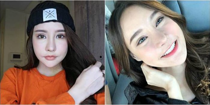 Operasi plastik Piya
