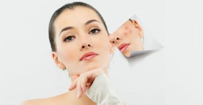 wajah mulus bebas jerawat dengan masker madu + kayu manis