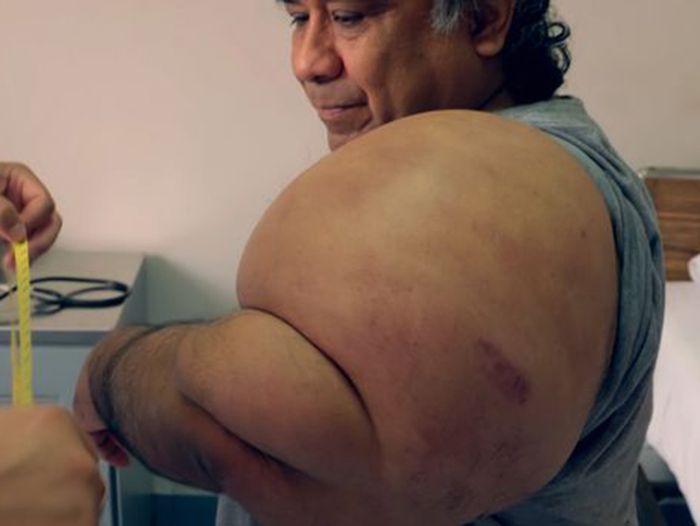 Alejandro Ramos memiliki tubuh seperti popeye.